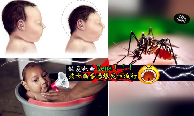 【兹卡病毒知多少？】世界卫生组织宣布兹卡病毒大爆发了，做爱也会传染，大家千万要Beware咯～