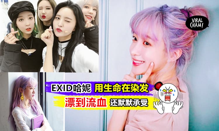 【搏命三娘?!】韩国女团EXID成员Hani为新专辑染发『漂到流血』! 还默默忍痛引人心疼… (内有影片)