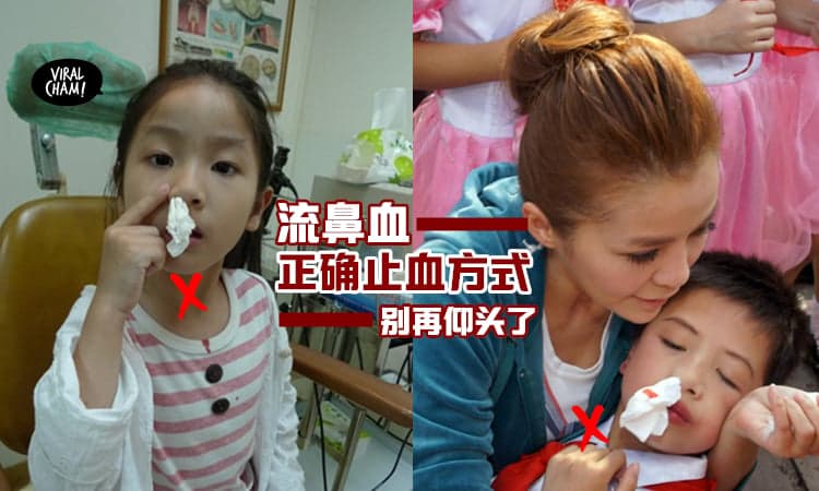 【最正确の止鼻血方式】仰头是没有用的！流鼻血当下应该要这样做才对~