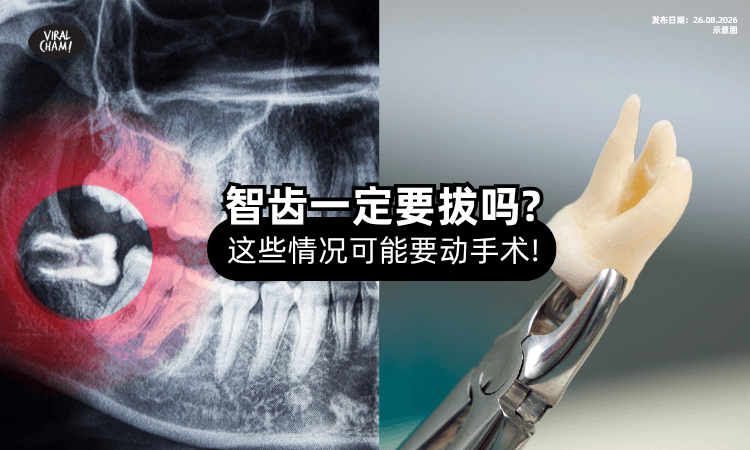 【智齿没痛就没事❓】PHM提醒「这些情况」可能出问题要动手术!